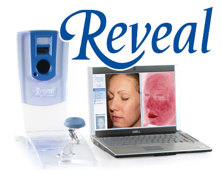 Reveal Imager